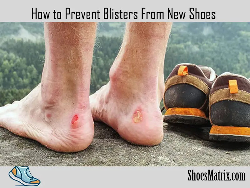 How to Prevent Blisters from New Shoes